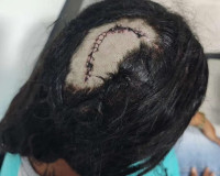 PC prende foragida que tentou matar mulher de seu ex-marido dentro de ônibus em Penedo